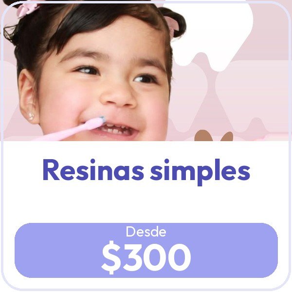 Resinas simples, desde $300.00